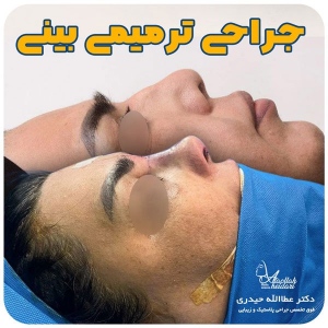جراحی-بینی-143