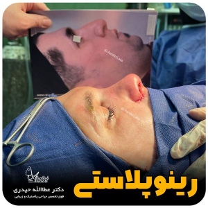 جراحی-بینی-159