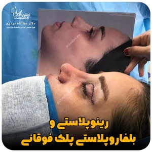 جراحی-بینی-168
