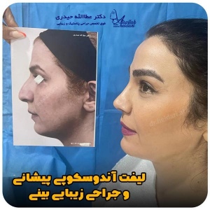 جراحی-بینی-232