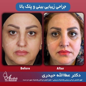 1_-بینی-2