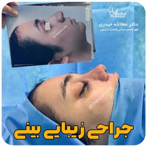 1_-بینی-222