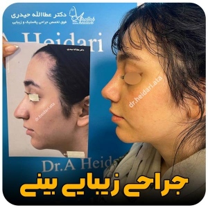 1_-بینی-223