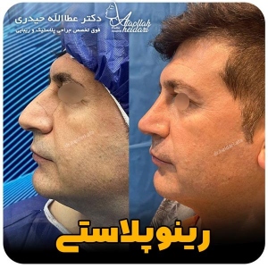 1_-بینی-224