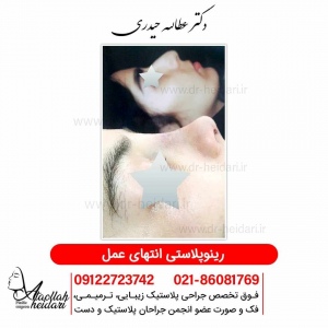 rhinoplasty12