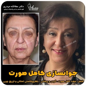جراحی-پلک24
