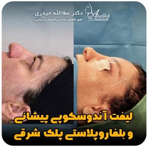 جراحی-پلک26