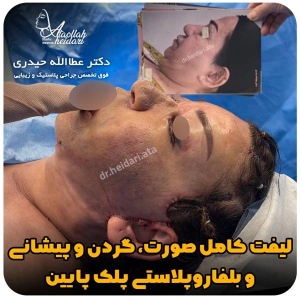 جراحی-پلک27