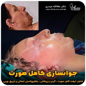 جراحی-پلک29