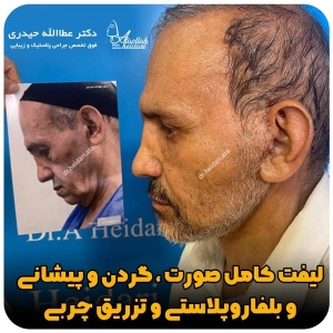 جراحی-پلک34