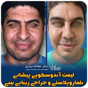 جراحی-پلک37