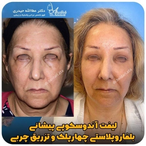 جراحی-پلک39