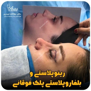 جراحی-پلک41