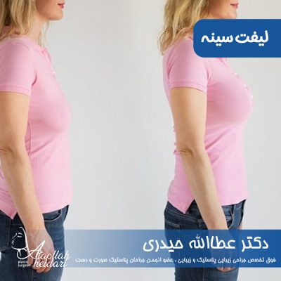 لیفت سینه در تهران - دکتر حیدری