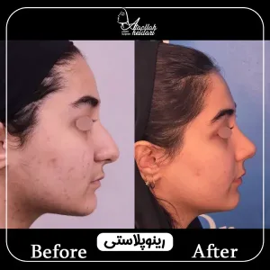 نمونه کارهای جراح پلاستیک در تهران _ دکتر عطاالله حیدری
