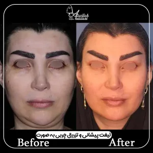 معرفی فوق تخصص جراحی پلاستیک در تهران _ دکتر عطاالله حیدری