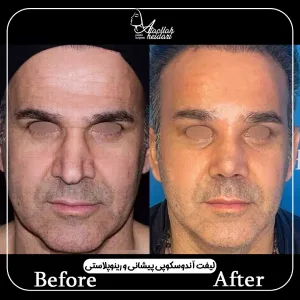 نمونه جراحی های فوق تخصص پلاستیک در تهران _ دکتر عطاالله حیدری
