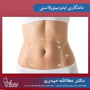 ماندگاری عمل ابدومینوپلاستی _ دکتر عطاالله حیدری