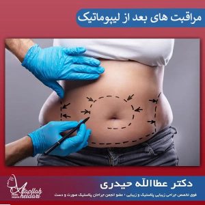 مراقبت های بعد از لیپوماتیک _ دکتر عطاالله حیدری