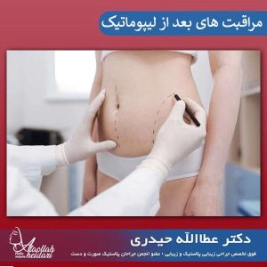 مراقبت های بعد از جراحی لیپوماتیک _ دکتر عطاالله حیدری