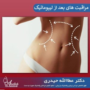 مراقبت های بعد از عمل لیپوماتیک _ دکتر عطاالله حیدری