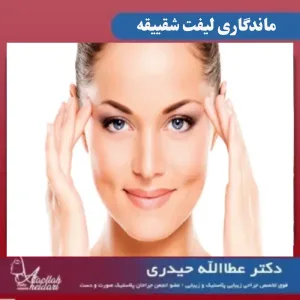 ماندگاری لیفت شقیقه _ دکتر عطاالله حیدری