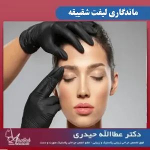 ماندگاری لیفت شقیقه _ دکتر عطاالله حیدری