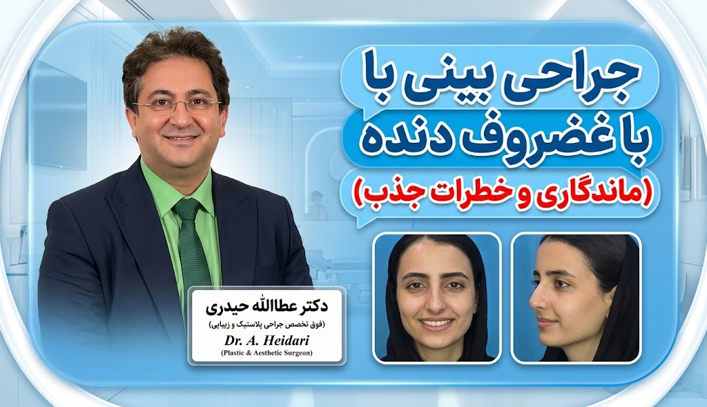 جراحی بینی با غضروف دنده (ماندگاری و خطرات جذب)