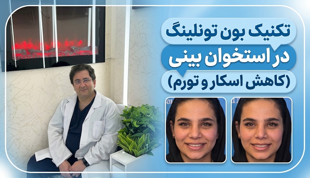 تکنیک بون تونلینگ در استخوان بینی (کاهش اسکار و تورم)
