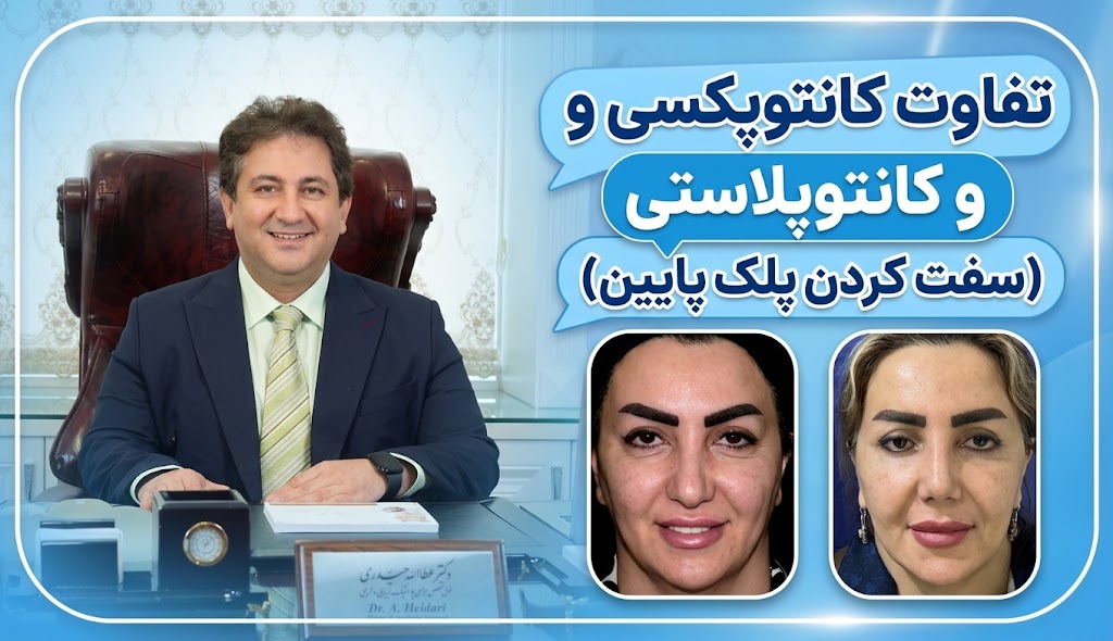 تفاوت کانتوپکسی و کانتوپلاستی (سفت کردن پلک پایین)
